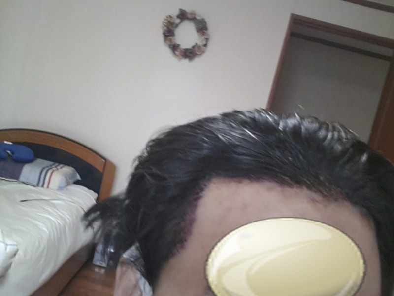 수술당일2.jpg