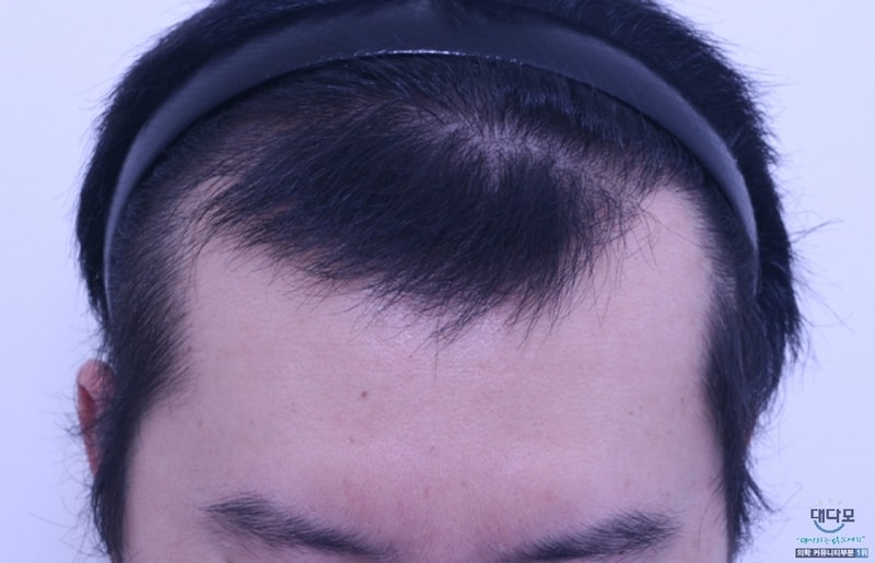 19f17b05f20e941fa93bd4bf563c5615.jpg