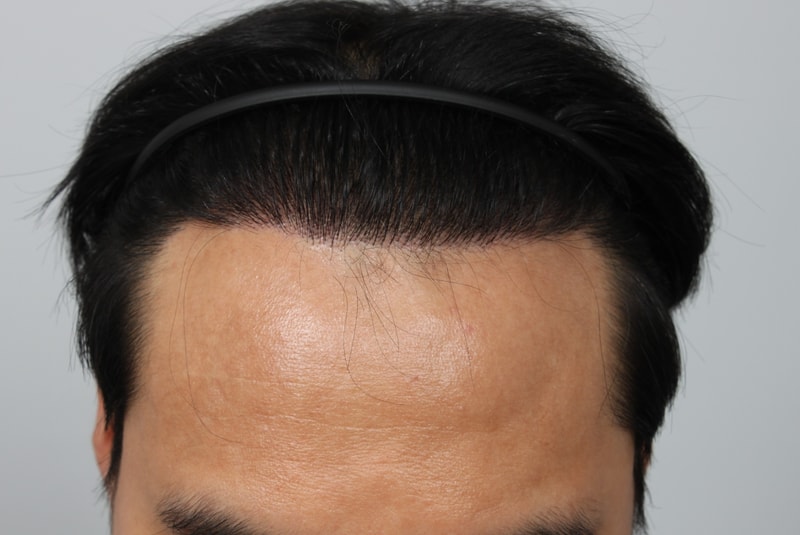 1년 경과 1.JPG