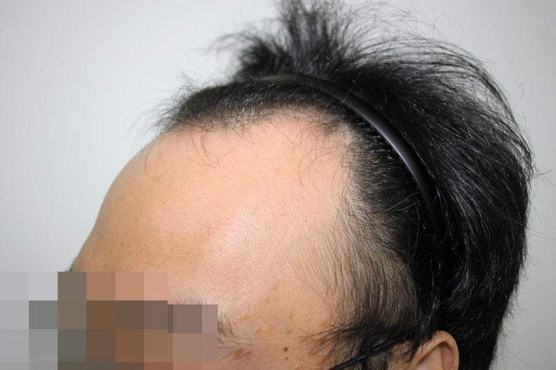 수술전 3.JPG