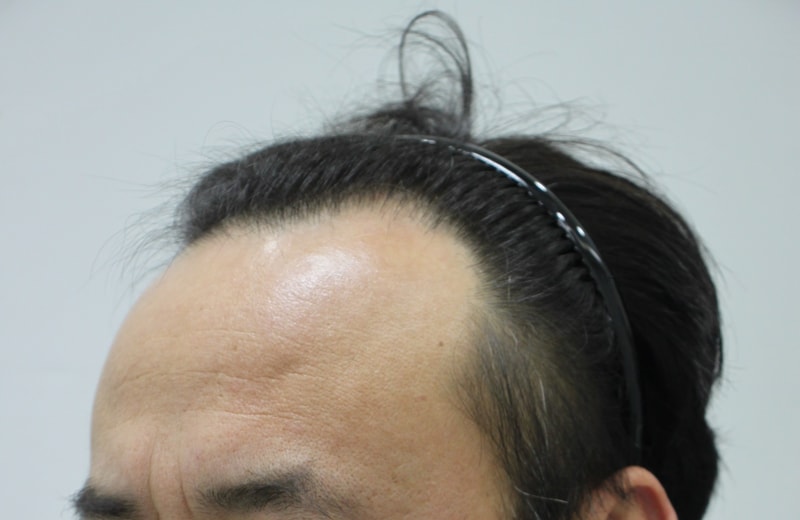 전 1.JPG