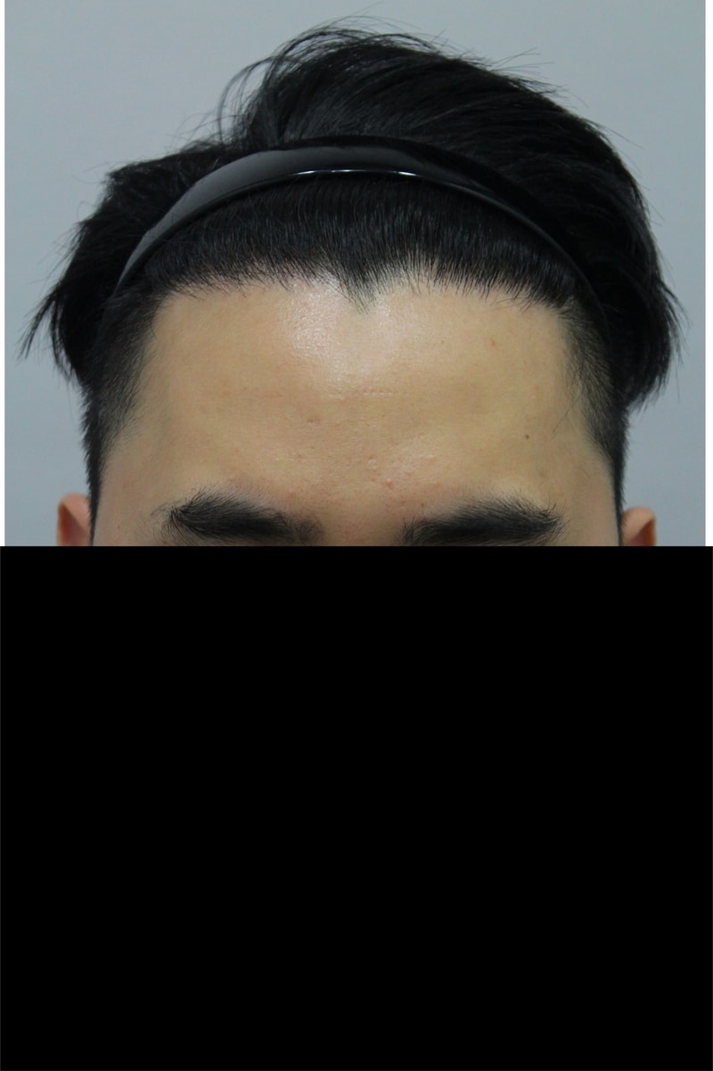 후 1.JPG