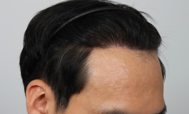 1년 경과 3.JPG