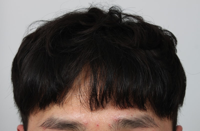 1년경과 2.JPG