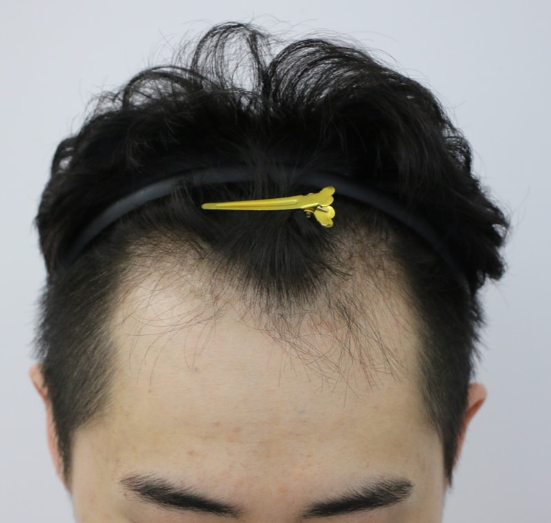 수술전.jpg