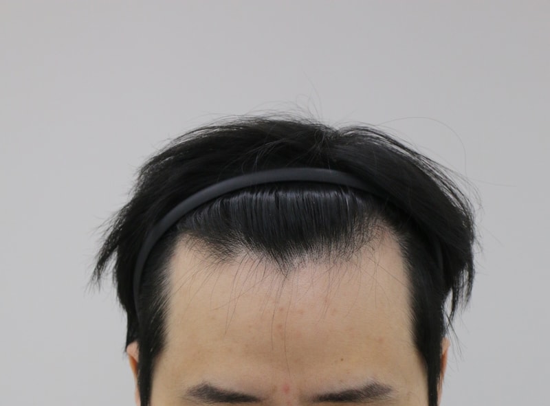 전 1.JPG