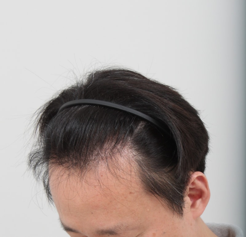 현수_7m-1.jpg