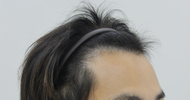 수술전 2.JPG