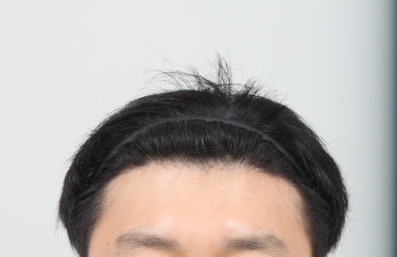 10개월후 1.JPG