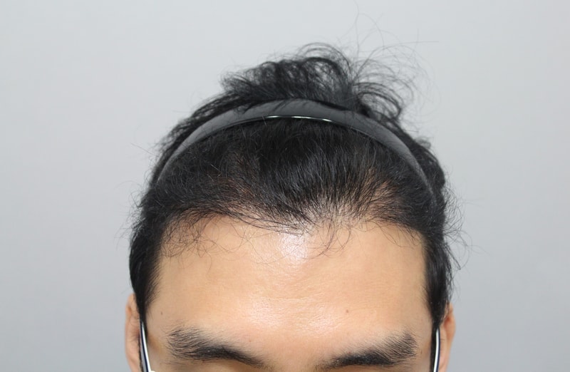 6개월1.jpg