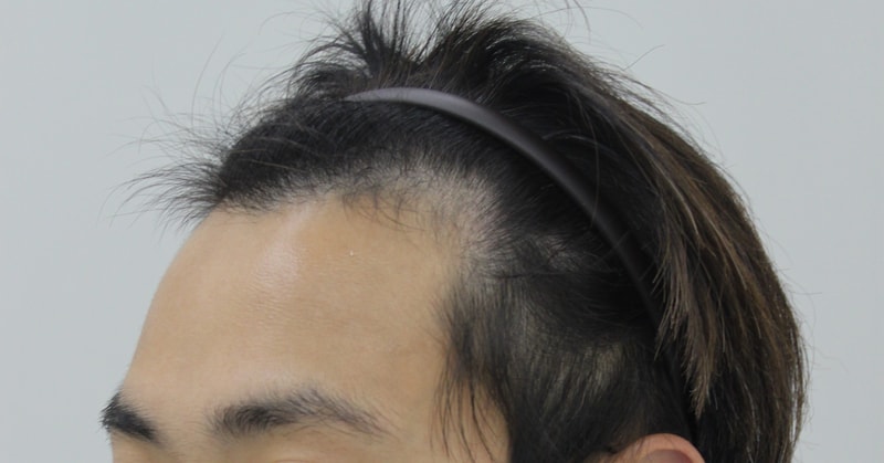 수술전 3.JPG