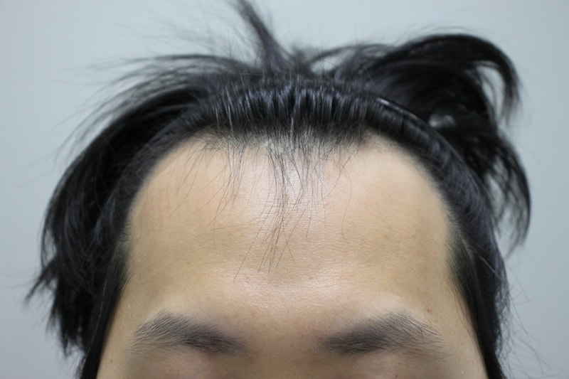 전 1.JPG