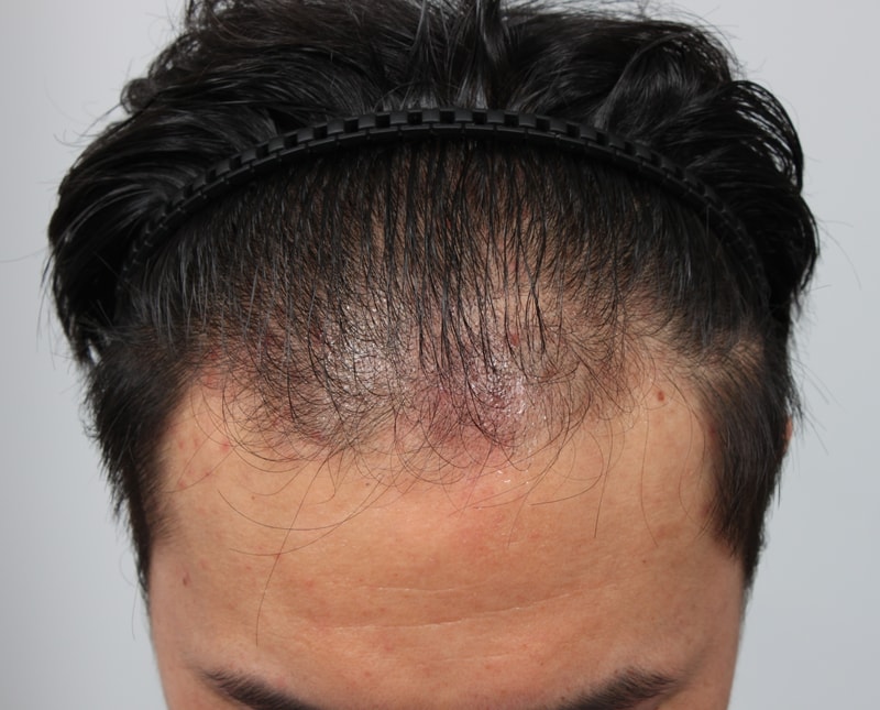 수술전 1.JPG