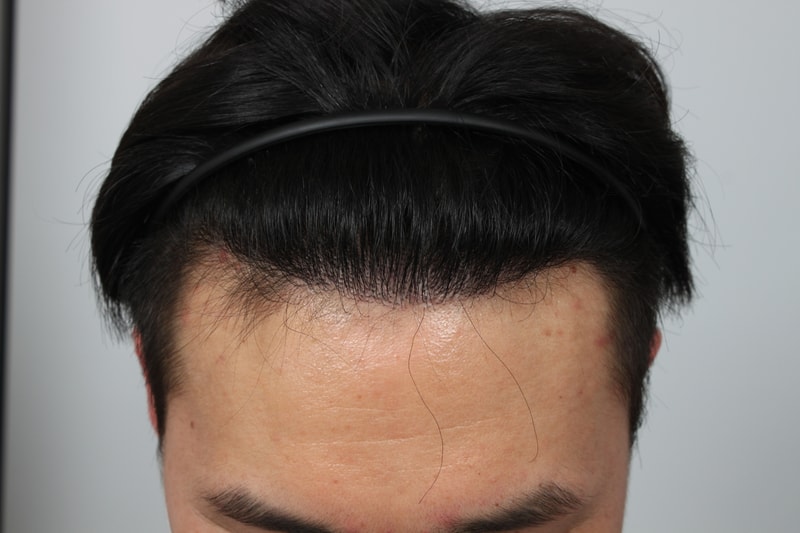 1년경과 1.JPG