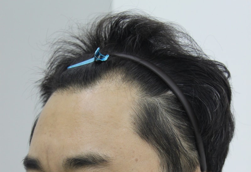 전 2.JPG