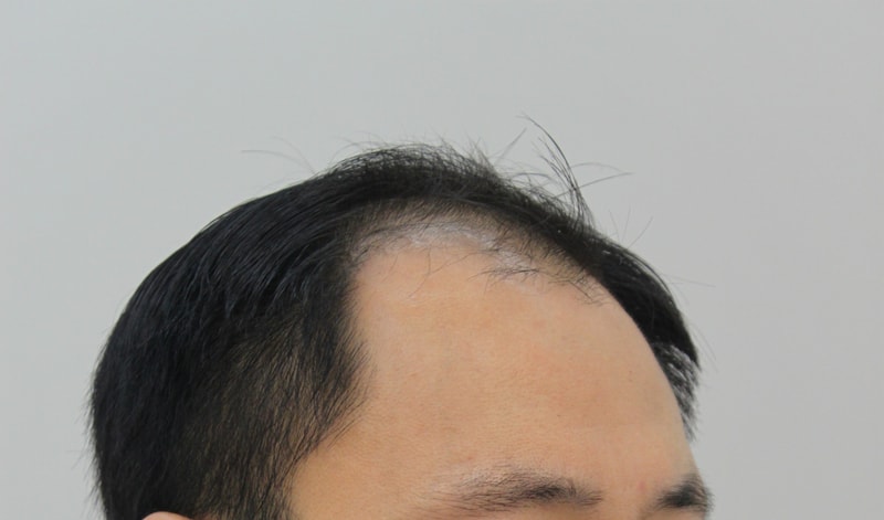 전 2.JPG
