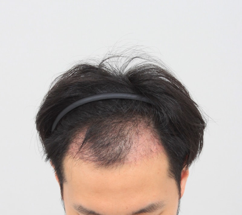 1개월.JPG