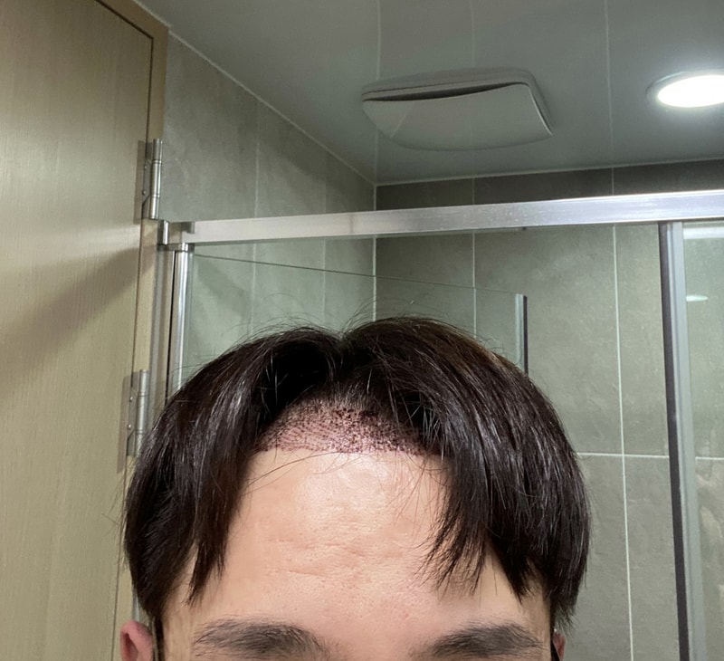 포헤어 3일차 셀카 일기