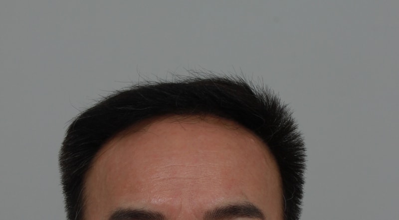 후 2.JPG