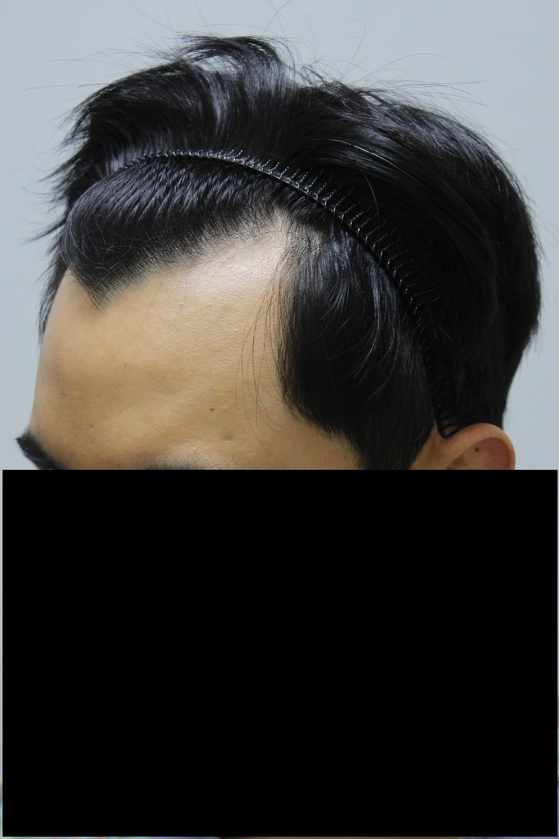 후 2.JPG