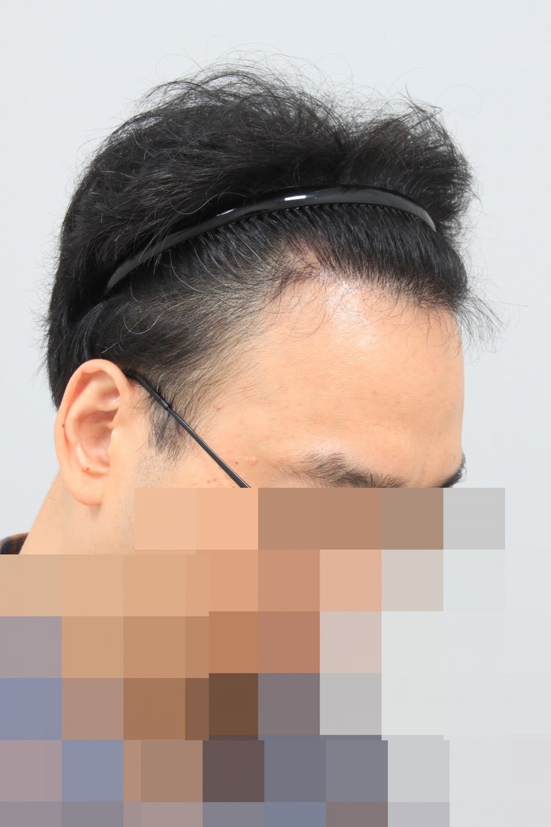 수술후 3.JPG