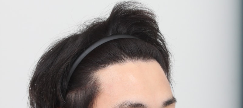 수술후 3.JPG