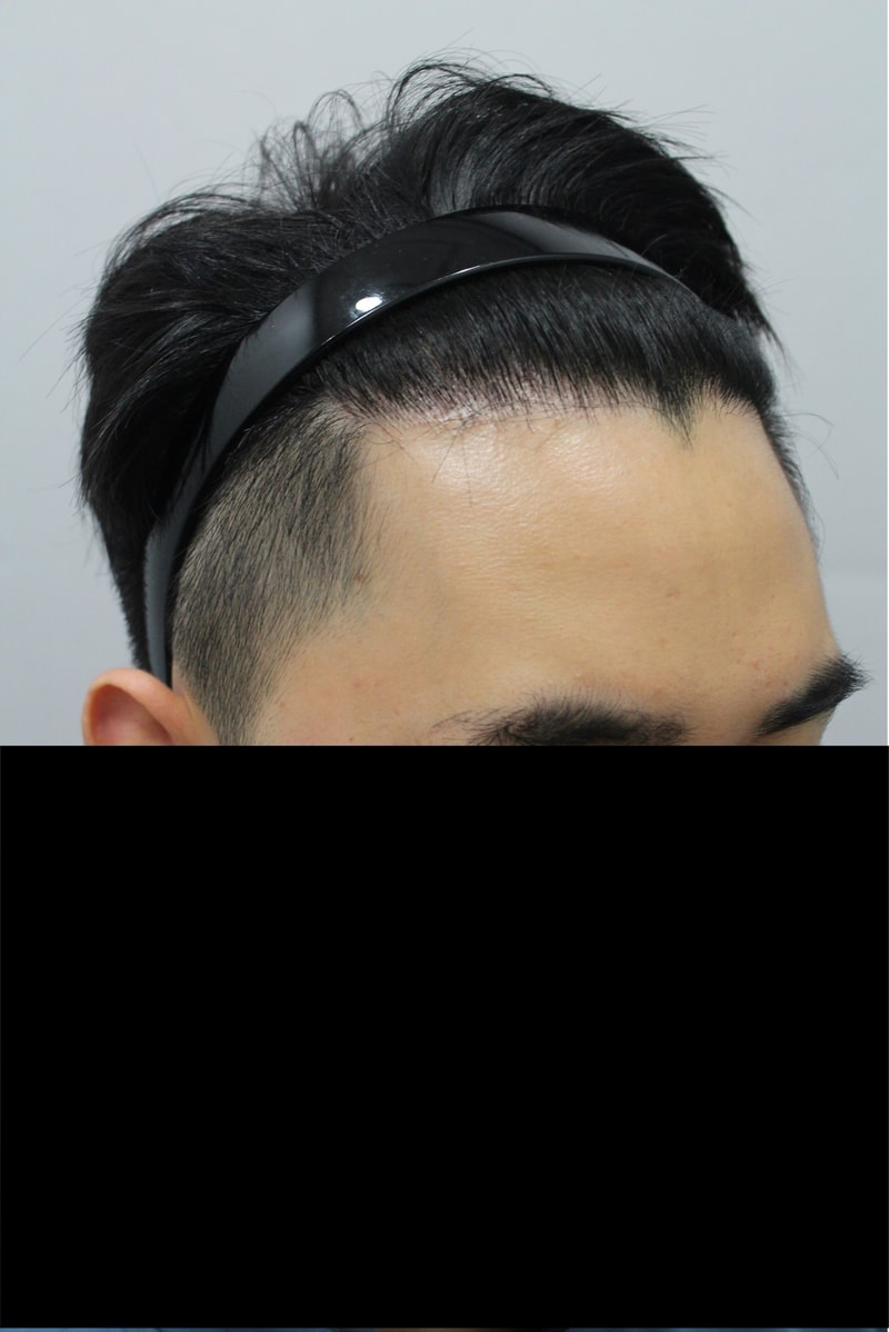 후 3.JPG