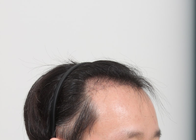 4개월후.JPG