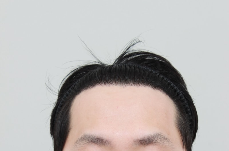 후 1.JPG