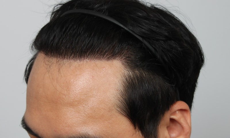 1년 경과 2.JPG