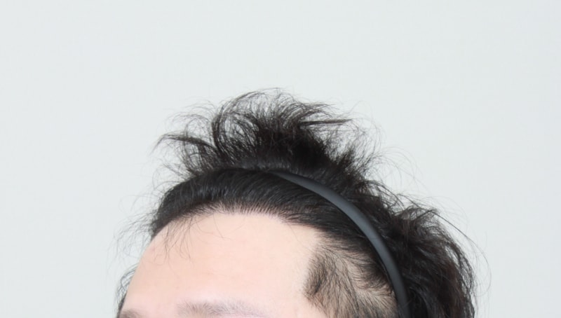 7개월후 1.JPG