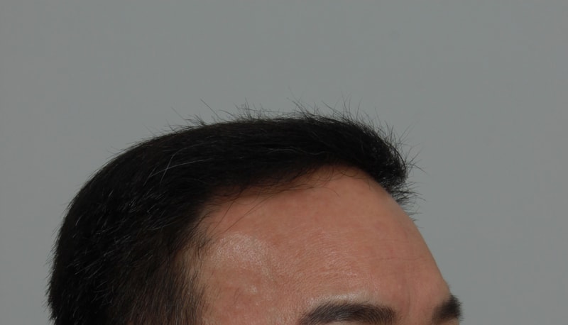 후 4.JPG