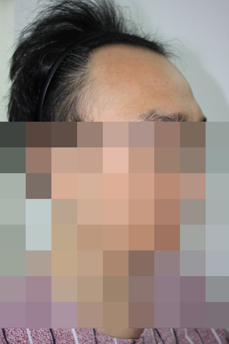 수술전 1.JPG