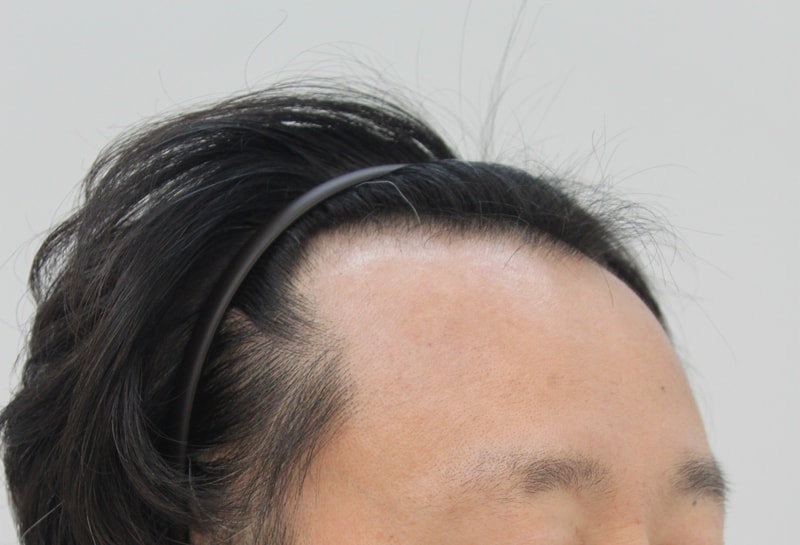 포헤어 4개월차 끝까지 잘해보겠습니다