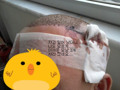 수술3일 후.jpg