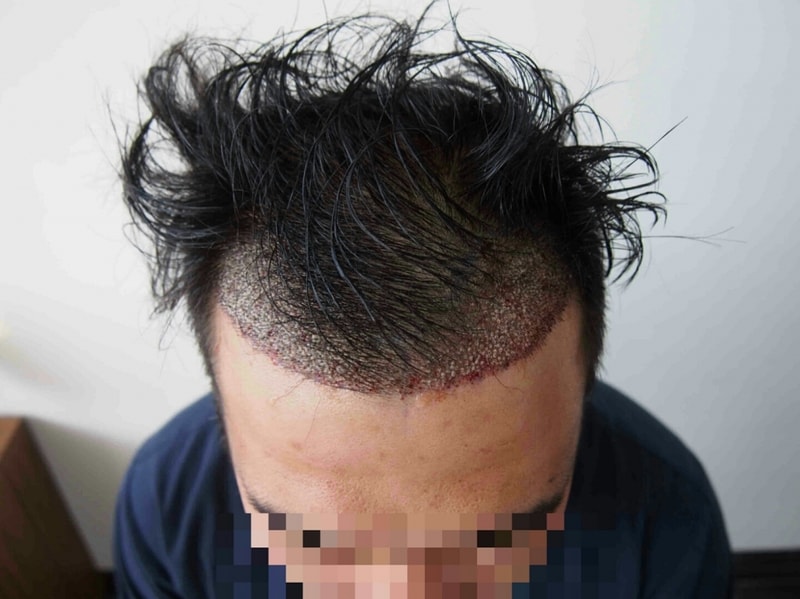 수술후11.jpg