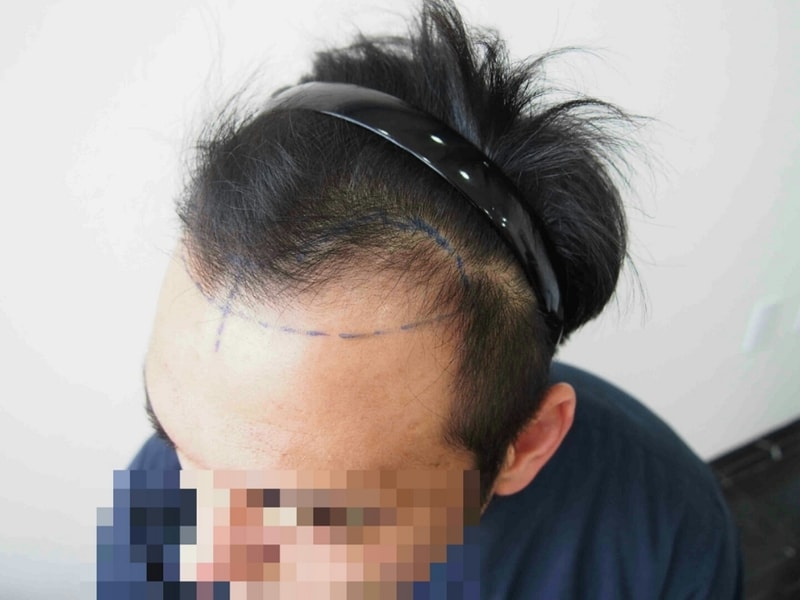 수술전33.jpg