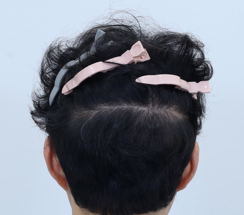 5. 후두부.jpg