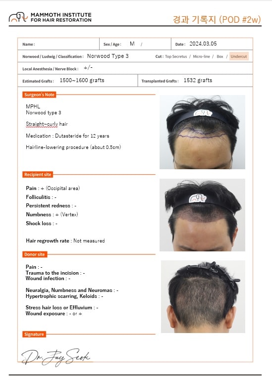 狎鴎亭 マンモス ヘアライン 男性のM字 毛髪移植2週目 レビュー