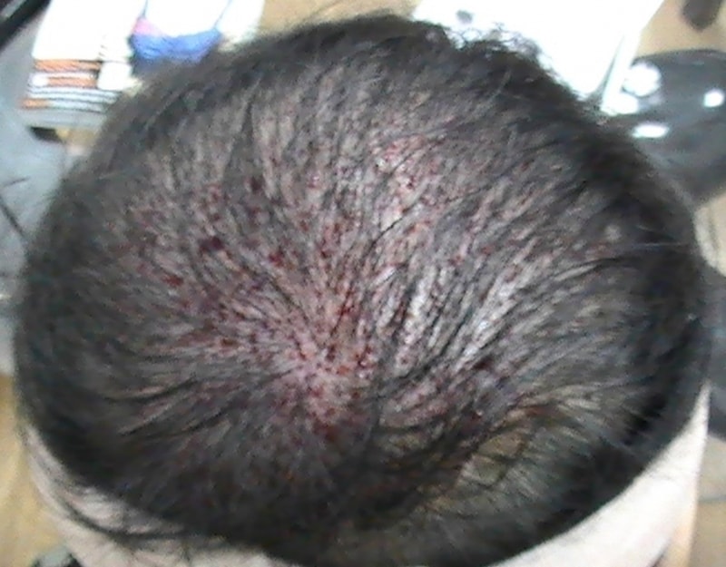 수술후1.jpg