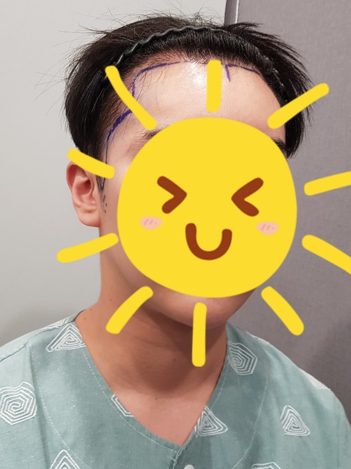 수술전2.jpg