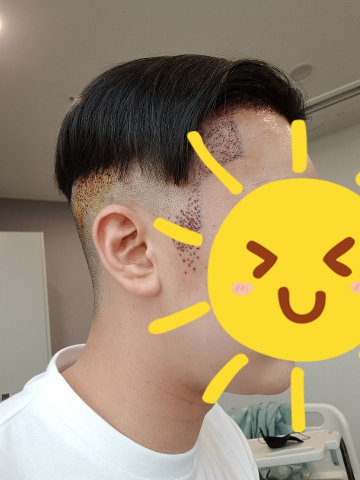 수술후4.jpg