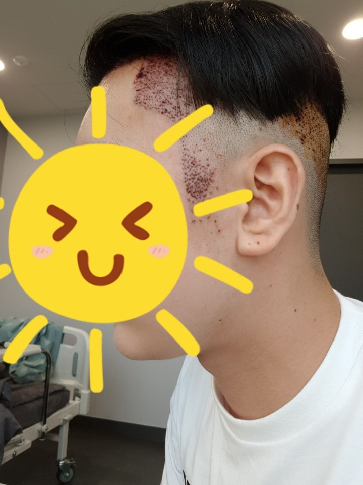 수술후5.jpg