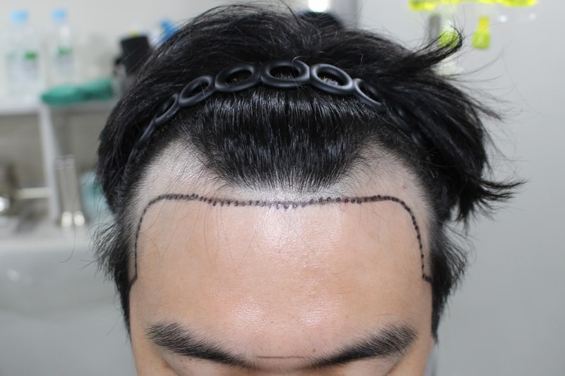 1000031219.jpg