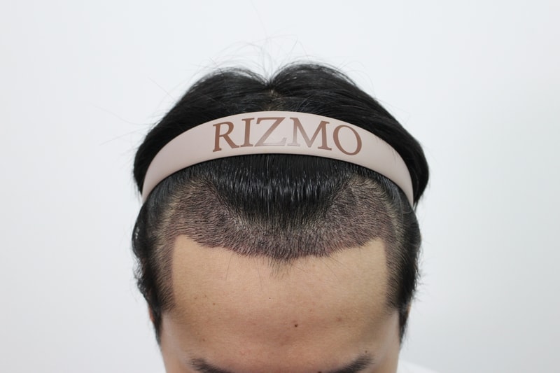 수술후2.jpg