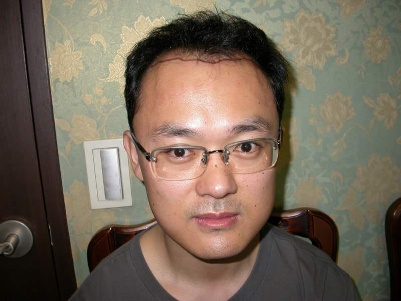 수술라인1.jpg