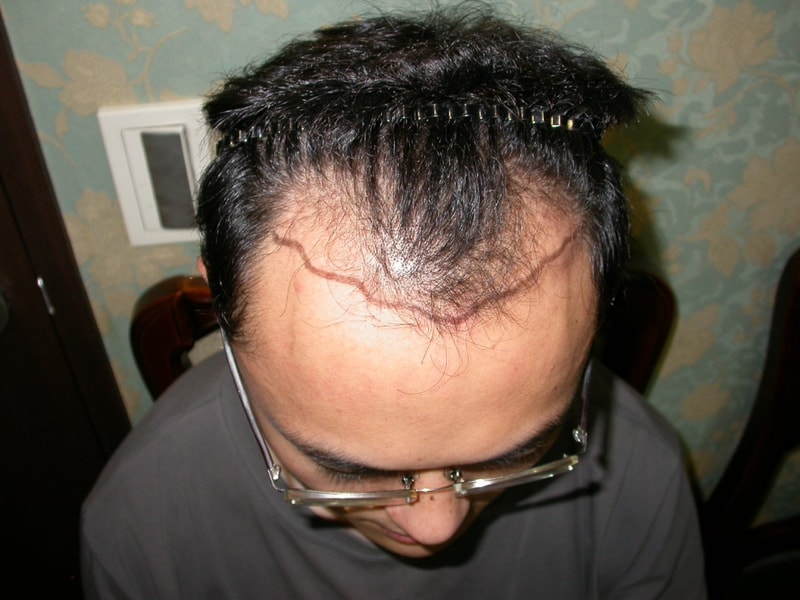 수술라인2.jpg