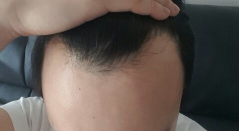 전.jpg