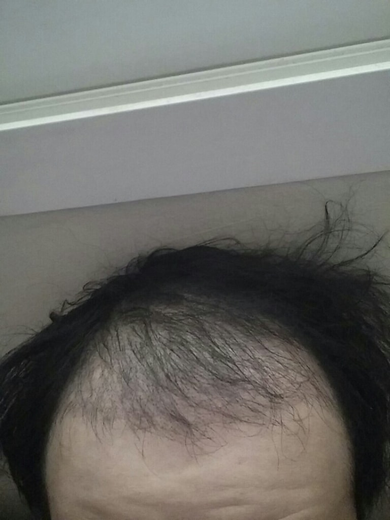 1개월.jpg
