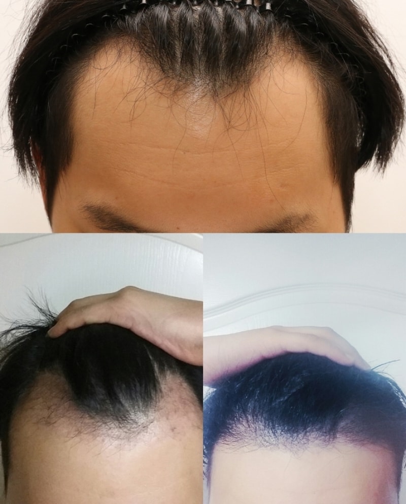 오잉.jpg